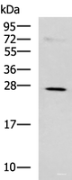 Western blot analysis of K562 cell lysate using NQO2 Polyclonal Antibody at dilution of 1:650