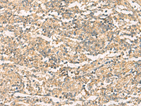 Immunohistochemistry of paraffin-embedded Human tonsil tissue using NQO2 Polyclonal Antibody at dilution of 1:50 (×200)