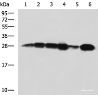 Western blot analysis of 293T cell Human bladder transitional cell carcinoma grade 2-3 tissue lysate MCF-7 cell lysates using MMAB Polyclonal Antibody at dilution of 1:1400