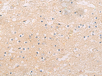 Immunohistochemistry of paraffin-embedded Human brain tissue using FYCO1 Polyclonal Antibody at dilution of 1:60 (×200)