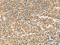 Immunohistochemistry of paraffin-embedded Human tonsil tissue using THG1L Polyclonal Antibody at dilution of 1:50 (×200)