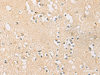 Immunohistochemistry of paraffin-embedded Human brain tissue using PDE4DIP Polyclonal Antibody at dilution of 1:45 (×200)