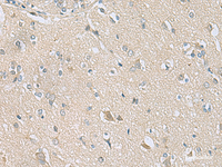 Immunohistochemistry of paraffin-embedded Human brain tissue using TSTA3 Polyclonal Antibody at dilution of 1:80 (×200)