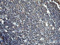 Immunohistochemistry of paraffin-embedded Human tonsil tissue using PRRT2 Polyclonal Antibody at dilution of 1:50 (×200)