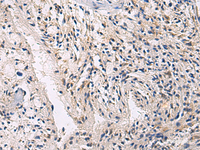 Immunohistochemistry of paraffin-embedded Human brain tissue using CEP89 Polyclonal Antibody at dilution of 1:100 (×200)