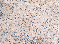 Immunohistochemistry of paraffin-embedded Human brain tissue using PA2G4 Polyclonal Antibody at dilution of 1:60 (×200)