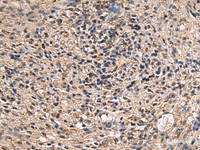 Immunohistochemistry of paraffin-embedded Human brain tissue using ITIH2 Polyclonal Antibody at dilution of 1:70 (×200)