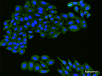 Immunofluorescence analysis of hepG2 cell using FLT1 Polyclonal Antibody at dilution of 1:100