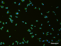 Immunofluorescence analysis of hela cell using SLC18A3 Polyclonal Antibody at dilution of 1:50