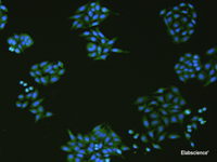 Immunofluorescence analysIs of HepG2 cell using SLC18A3 Polyclonal Antibody at dilution of 1:50