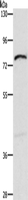 Western blot analysis of Mouse intestinum tenue tissue using XPNPEP1 Polyclonal Antibody at dilution of 1:600