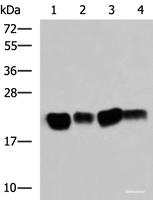 Western blot analysis of Mouse brain tissue SKOV3 cell Rat brain tissue Mouse kidney tissue lysates using HRAS Polyclonal Antibody at dilution of 1:500