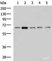 Western blot analysis of 293T LOVO Hela and Jurkat cell lysates using CHEK2 Polyclonal Antibody at dilution of 1:600