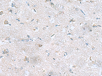 Immunohistochemistry of paraffin-embedded Human brain tissue using GFRA1 Polyclonal Antibody at dilution of 1:65 (×200)