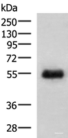 Western blot analysis of Human placenta tissue lysate using GFRA2 Polyclonal Antibody at dilution of 1:400