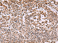 Immunohistochemistry of paraffin-embedded Human tonsil tissue using SMAD7 Polyclonal Antibody at dilution of 1:40 (×200)