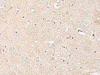 Immunohistochemistry of paraffin-embedded Human brain tissue using VEGFA Polyclonal Antibody at dilution of 1:60 (×200)