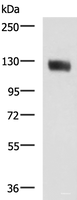 Western blot analysis of Human leiomyosarcoma tissue lysate using MCAM Polyclonal Antibody at dilution of 1:400