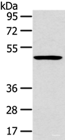 Western blot analysis of 231 cell using HTRA1 Polyclonal Antibody at dilution of 1:500