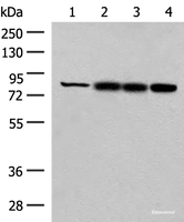 Western blot analysis of Human kidney tissue Rat liver tissue Mouse liver tissue and A172 cell lysates using HNF1A Polyclonal Antibody at dilution of 1:250