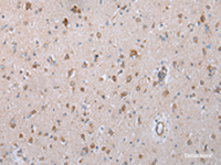 Immunohistochemistry of paraffin-embedded Human brain tissue using COX7C Polyclonal Antibody at dilution of 1:40 (×200)