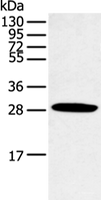 Western blot analysis of Human normal lung tissue using CLDN25 Polyclonal Antibody at dilution of 1:250