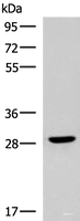 Western blot analysis of Human fetal brain tissue lysate using CLEC9A Polyclonal Antibody at dilution of 1:800