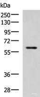 Western blot analysis of MCF7 cell lysate using ECM1 Polyclonal Antibody at dilution of 1:1000