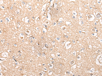 Immunohistochemistry of paraffin-embedded Human brain tissue using MTNR1B Polyclonal Antibody at dilution of 1:55 (×200)