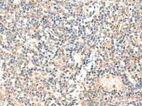 Immunohistochemistry of paraffin-embedded Human tonsil tissue using ADAMTS2 Polyclonal Antibody at dilution of 1:40 (×200)