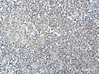 Immunohistochemistry of paraffin-embedded Human tonsil tissue using MEF2D Polyclonal Antibody at dilution of 1:50 (×200)