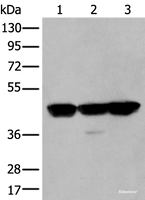 Western blot analysis of Hela A431 and Hepg2 cell lysates using PLAG1 Polyclonal Antibody at dilution of 1:200