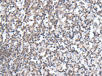 Immunohistochemistry of paraffin-embedded Human tonsil tissue using PLAG1 Polyclonal Antibody at dilution of 1:25 (×200)