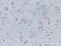 Immunohistochemistry of paraffin-embedded Human brain tissue using EFNB1 Polyclonal Antibody at dilution of 1:50 (×200)