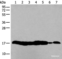 Western blot analysis of 293T and NIH/3T3 cell Mouse liver tissue HUVEC cell lysates using HIST1H3A Polyclonal Antibody at dilution of 1:250