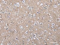 Immunohistochemistry of paraffin-embedded Human brain tissue using WIF1 Polyclonal Antibody at dilution of 1:100 (×200)