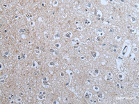 Immunohistochemistry of paraffin-embedded Human brain tissue using BRSK2 Polyclonal Antibody at dilution of 1:70 (×200)