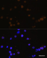 Immunofluorescence analysis of Y79 cells using Rb Polyclonal Antibody at dilution of 1:100 (40x lens) . Blue: DAPI for nuclear staining.