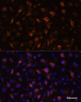 Immunofluorescence analysis of RAW264.7 cells using TLR4 Polyclonal Antibody at dilution of 1:100 (40x lens) . Blue: DAPI for nuclear staining.