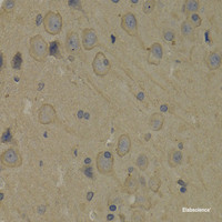 Immunohistochemistry of paraffin-embedded Rat brain using PI3 Kinase p85 alpha Polyclonal Antibody at dilution of 1:100 (40x lens) .