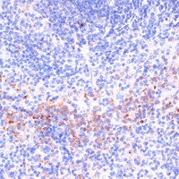 Immunohistochemistry of paraffin-embedded Mouse spleen using Perforin Polyclonal Antibody at dilution of 1:100 (40x lens) .