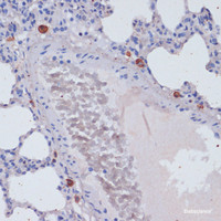 Immunohistochemistry of paraffin-embedded Rat lung using Perforin Polyclonal Antibody at dilution of 1:100 (40x lens) .