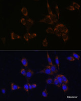 Immunofluorescence analysis of NIH/3T3 cells using Perforin Polyclonal Antibody at dilution of 1:100. Blue: DAPI for nuclear staining.