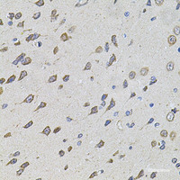 Immunohistochemistry of paraffin-embedded Rat brain using FoxO3a Polyclonal Antibody at dilution of 1:100 (40x lens) .