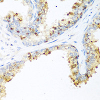 Immunohistochemistry of paraffin-embedded Human prostate using LRP5 Polyclonal Antibody at dilution of 1:200 (40x lens) .