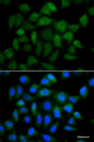 Immunofluorescence analysis of HeLa cells using AFP Polyclonal Antibody