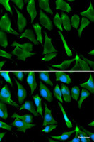 Immunofluorescence analysis of A549 cells using BRCA1 Polyclonal Antibody