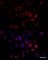 Immunofluorescence analysis of HeLa cells using Caspase-3 Polyclonal Antibody at dilution of 1:100 (40x lens) . Blue: DAPI for nuclear staining.