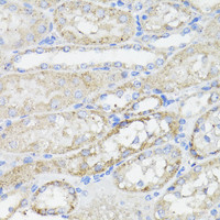 Immunohistochemistry of paraffin-embedded Mouse kidney using Caspase-8 Polyclonal Antibody at dilution of 1:200 (40x lens) .
