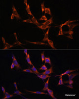 Immunofluorescence analysis of NIH/3T3 cells using Caspase-8 Polyclonal Antibody at dilution of 1:100. Blue: DAPI for nuclear staining.